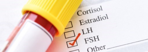 בדיקת Follicle Stimulating Hormone  (בקיצור - FSH) - תמונה